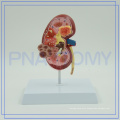 PNT-0739 China Best Kidney with best service and low price